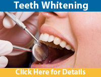 Flatbush Teeth Whitening Dentist