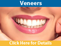 Brooklynl Veneer Dentist